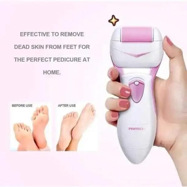 Foot Care Pedicure Device - Image 4